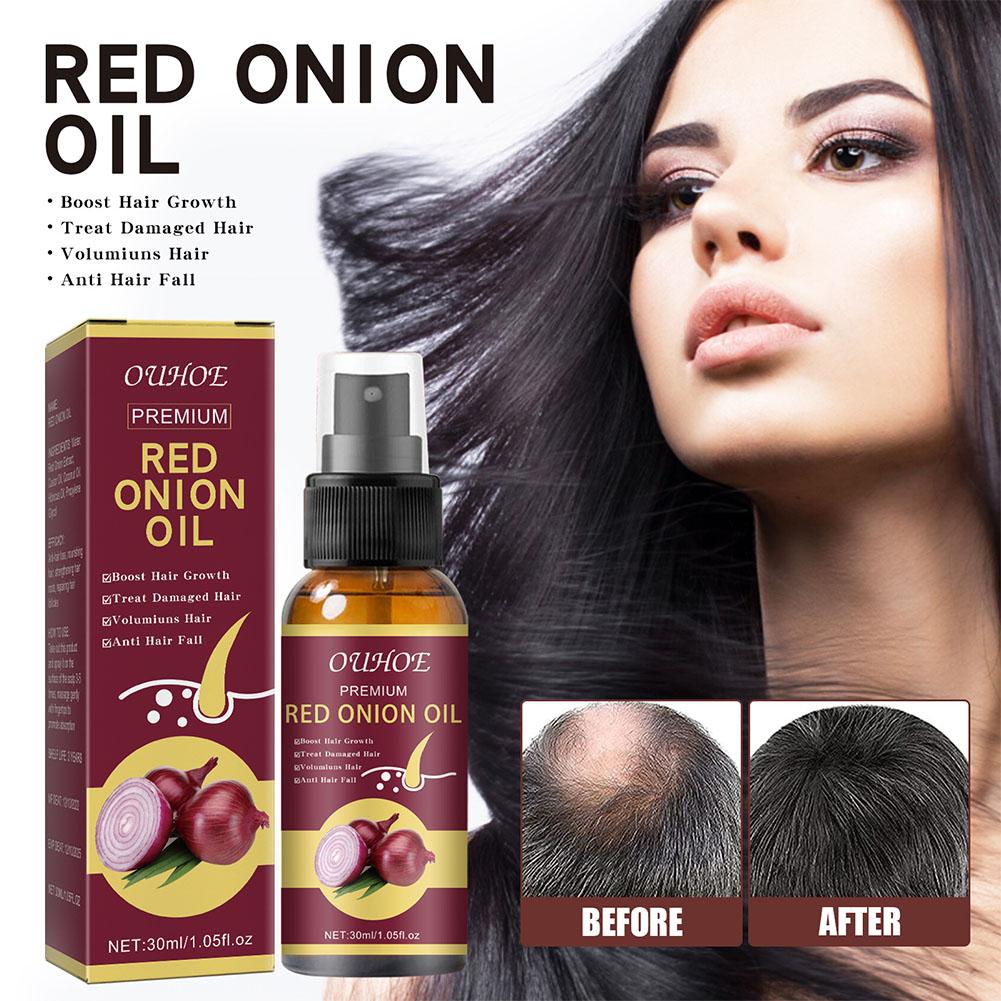 OUHOE Red Onion Essential Oil  - Hair Care Ouai ulasan dan harga