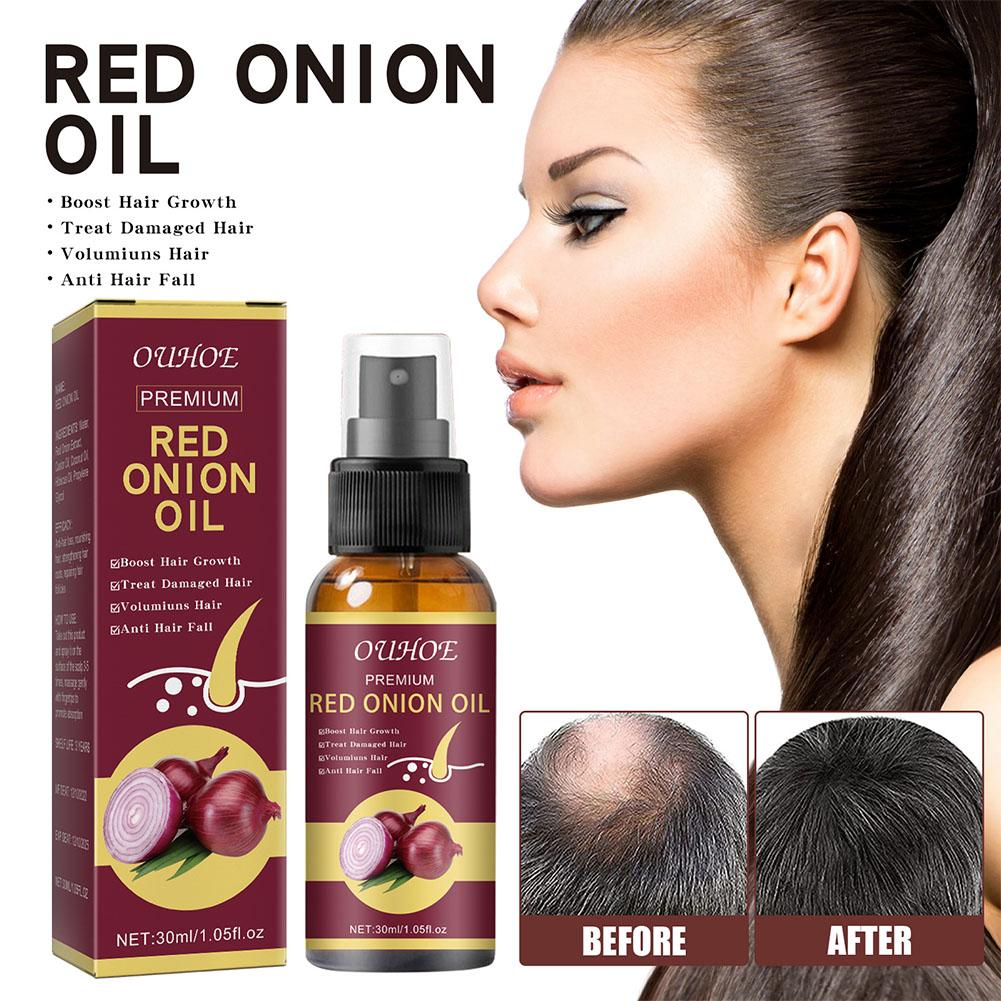 OUHOE Red Onion Essential Oil  - Hair Care Ouai ulasan dan harga
