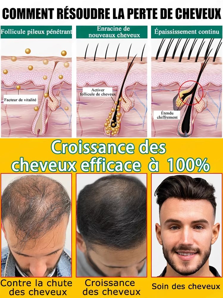 Matches Daily Scalp Care Steps - Hair Care Steps ulasan dan harga
