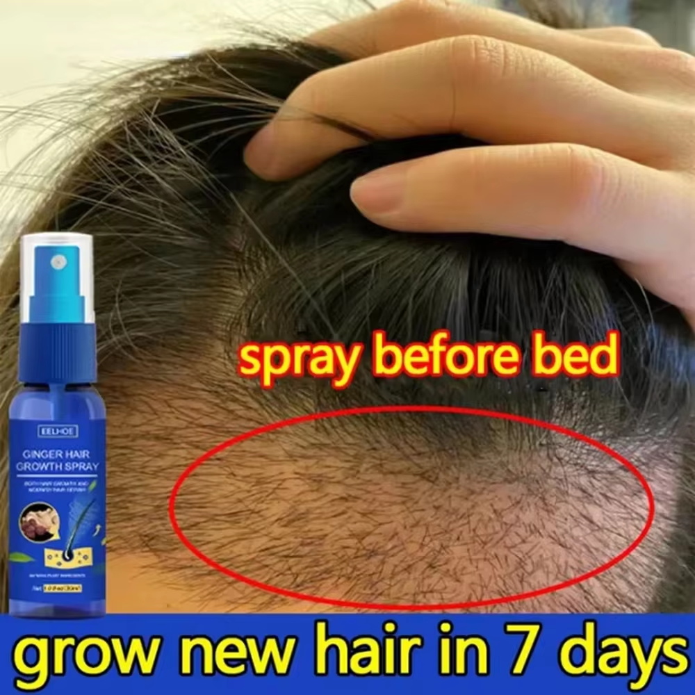 Fast Ginger Hair Growth Spray  - Hair Care Growth ulasan dan harga